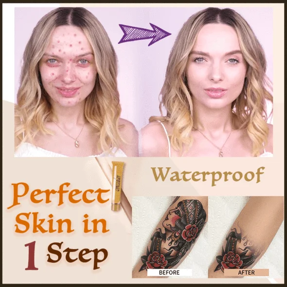 ElectroMatic epilator za uvlačenje dlačica