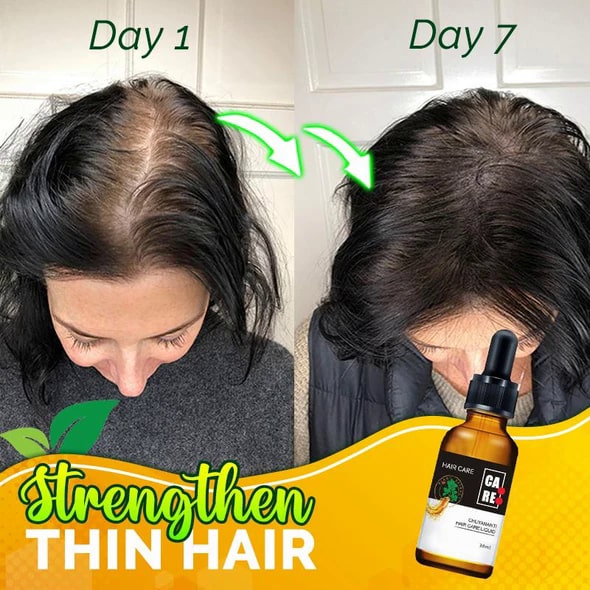 10X-Regro Strong serum za kosu