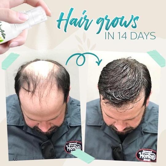 Hair-Active Root-Boost sprej od đumbira - Slika 2