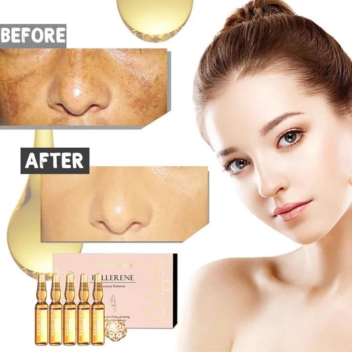 Ampule za izbjeljivanje bez mrlja (komplet od 7) - Slika 2