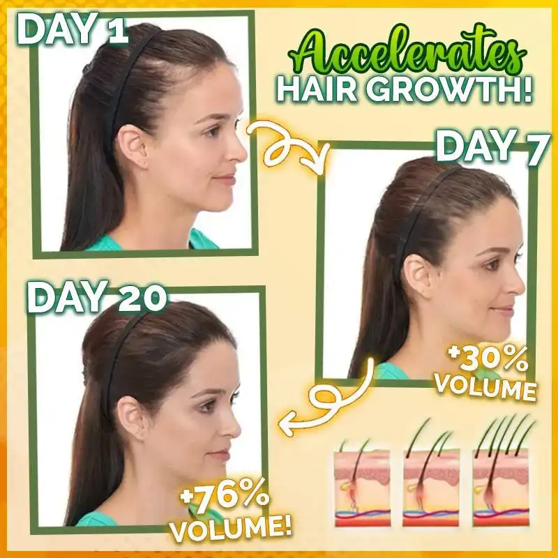 10X-Regro Strong serum za kosu - Slika 2