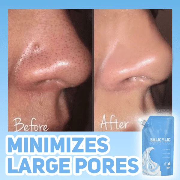 Salicilna hidromaska - Slika 3