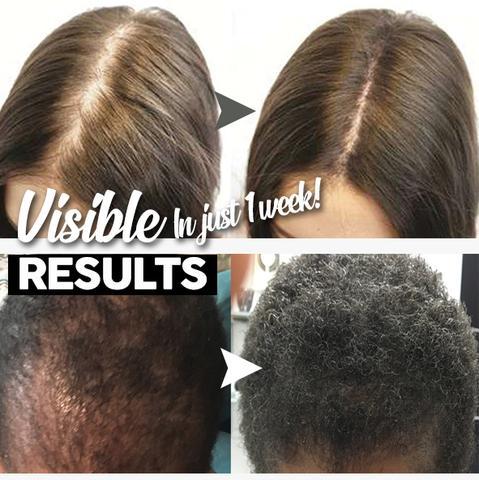 Šampon za rast kose - Slika 4