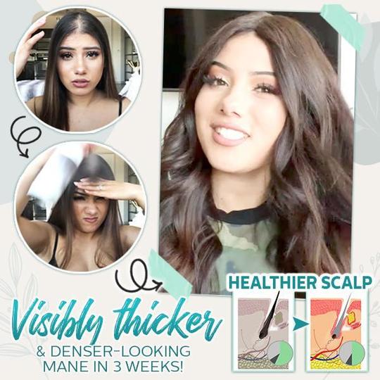 Hair-Active Root-Boost sprej od đumbira - Slika 4