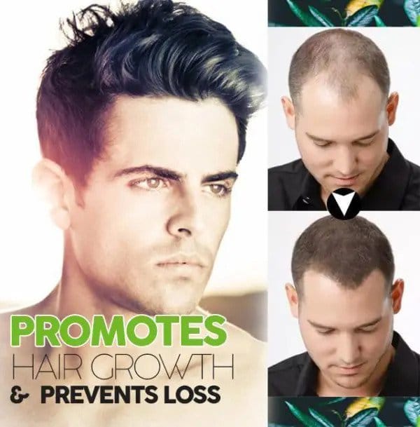 Organsko rješenje za tamnjenje kose - Slika 3