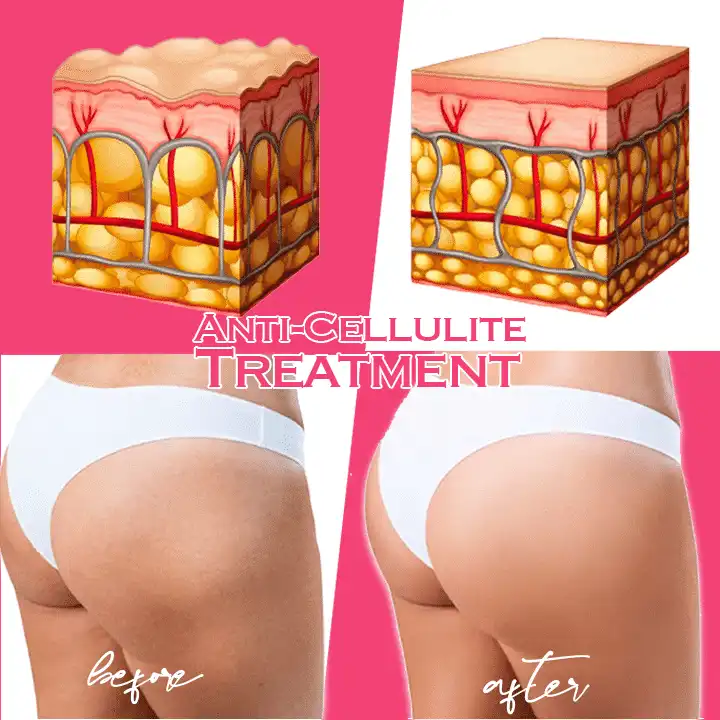 Kofein Firm & Tonska krema - Slika 4