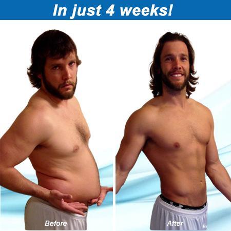 Smanjujuće magnetske naušnice za mršavljenje - Slika 4