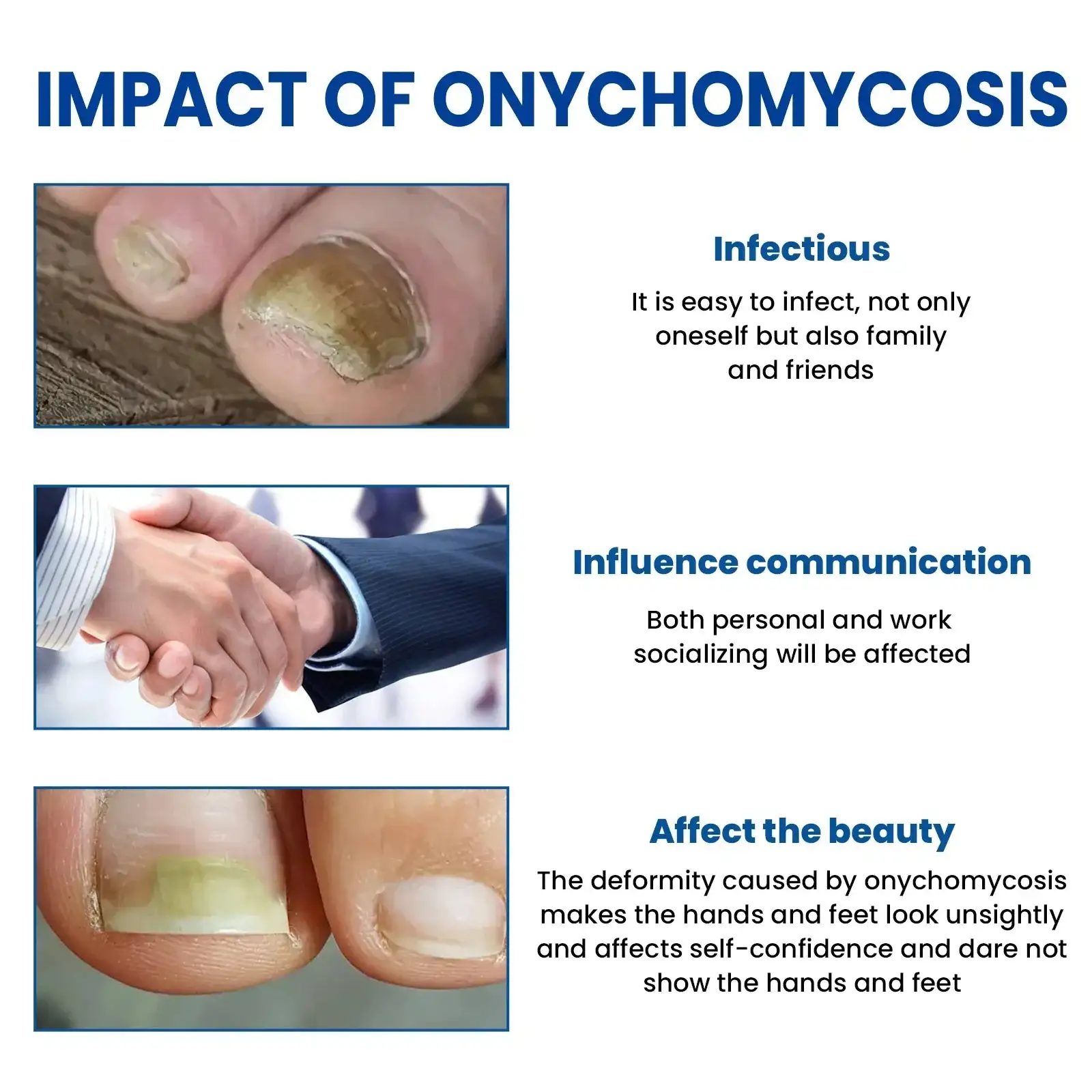 Flasteri za popravak gljivica na noktima - Slika 2