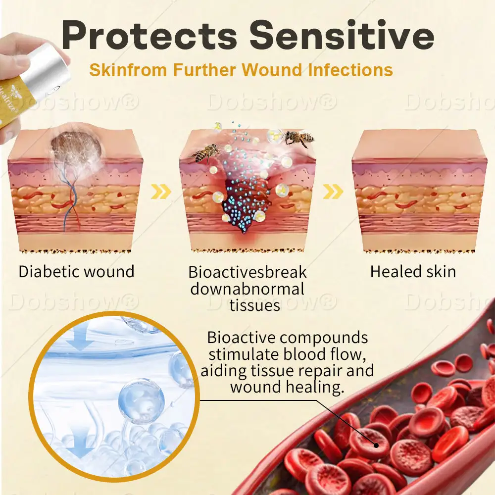 GlucoShield sprej za rane od pčelinjeg otrova - Slika 3