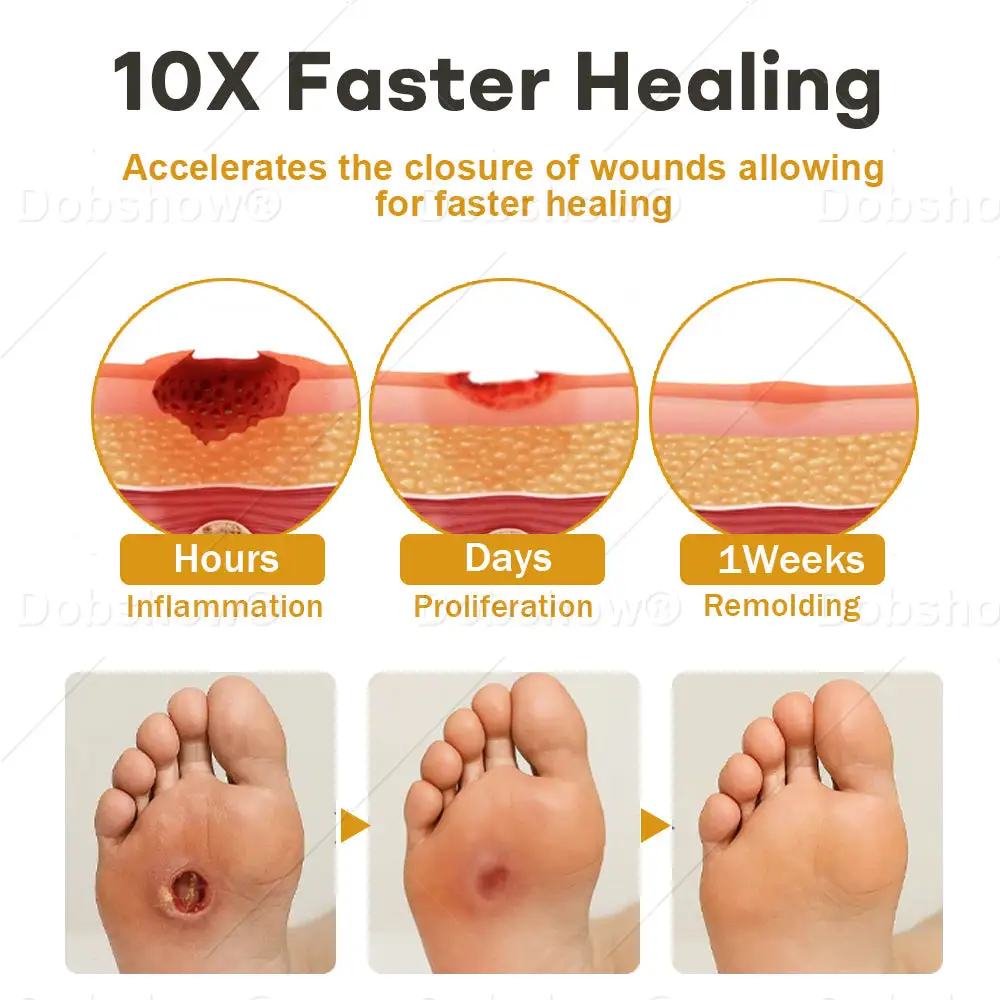 GlucoShield sprej za rane od pčelinjeg otrova - Slika 4