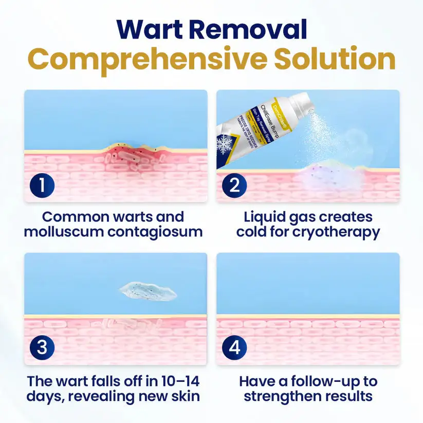 ChillErase Bump & Sprej za obnovu kožnih oznaka - Slika 4