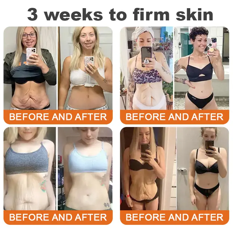 pčelinji otrov za učvršćivanje seruma u stiku - Slika 2