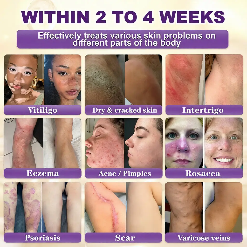 Biotin 10-u-1 krema za obnavljanje kože - Slika 2