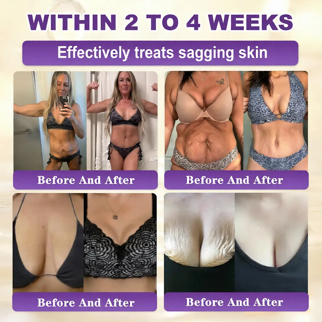 Biotin 10-u-1 krema za obnavljanje kože - Slika 3