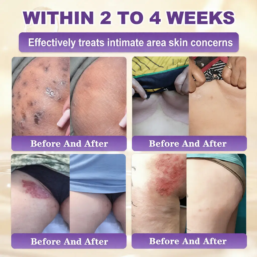 Biotin 10-u-1 krema za obnavljanje kože - Slika 4