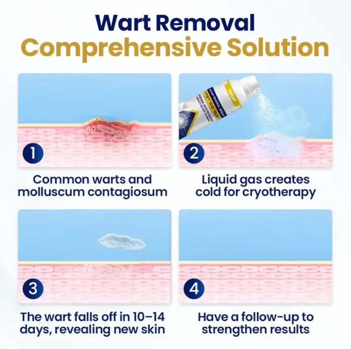 Chillique sprej za obnovu neravnina - Slika 3