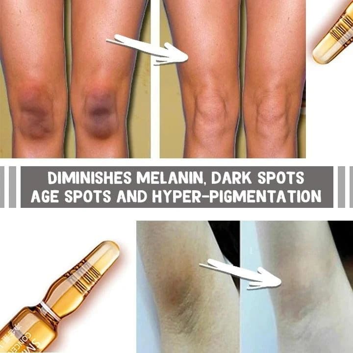 Ampule za izbjeljivanje bez mrlja (komplet od 7) - Slika 3